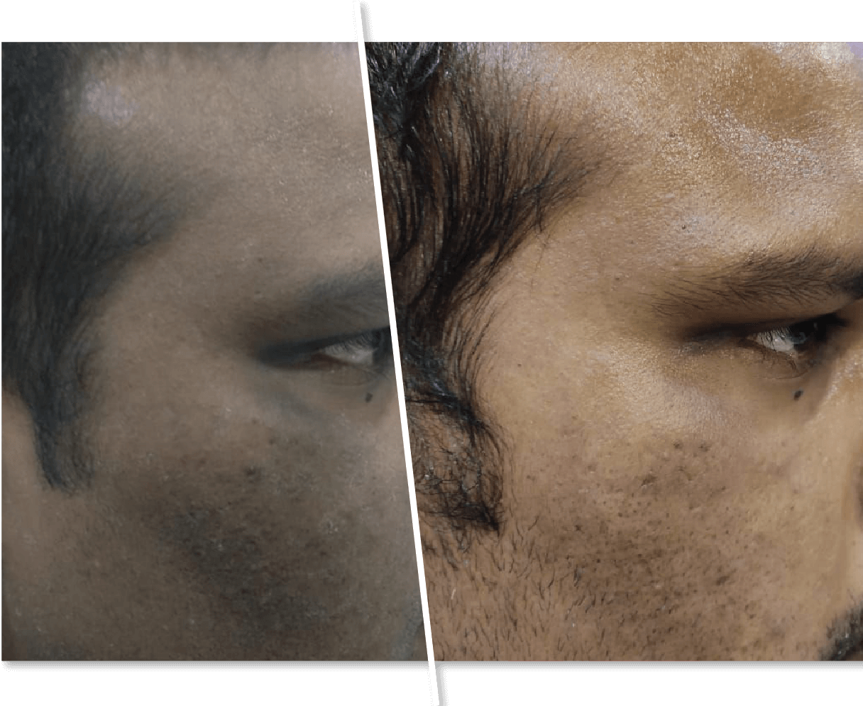 Men Before and After Skin Polishing 